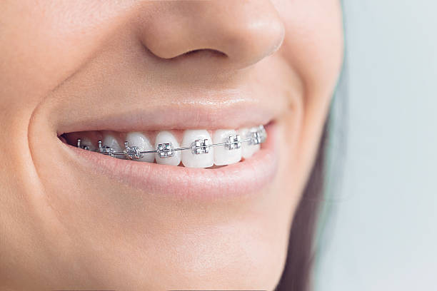 Best Traditional Braces  in Pontotoc, MS